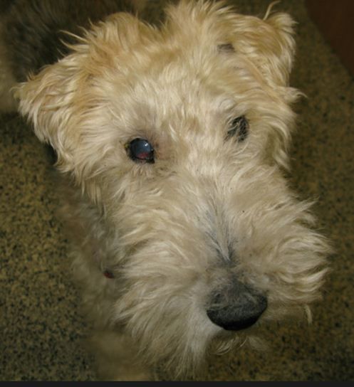 2 weeks post excision of the limbal melanoma in the right eye